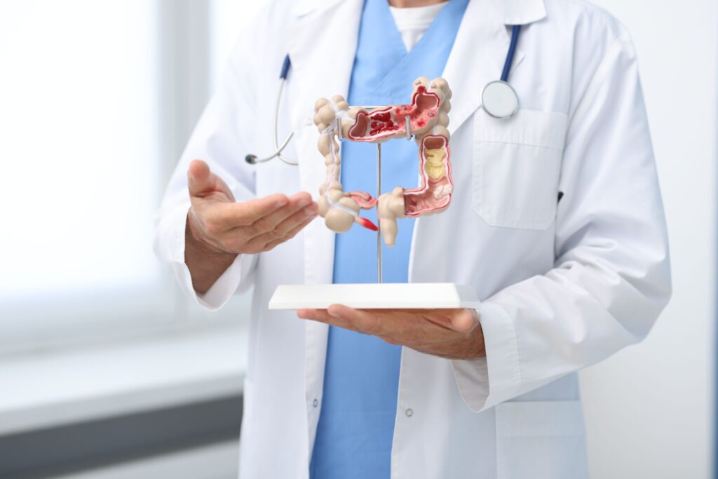 Uchyłki jelita grubego – co to jest, jak powstają i jakie są objawy?