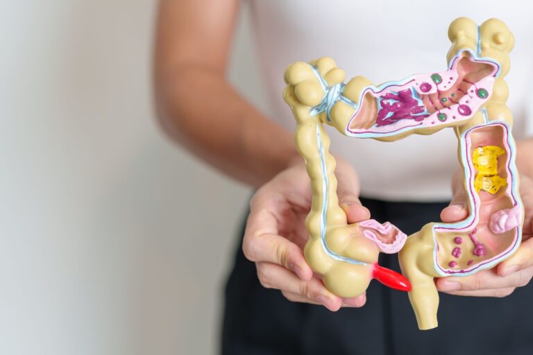 Zespół jelita drażliwego - przyczyny, objawy i codzienne funkcjonowanie z IBS